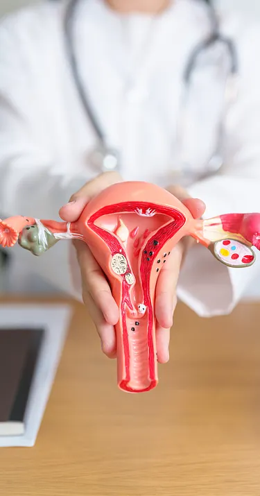Die Ursachen von Endometriose sind noch nicht vollständig geklärt.