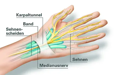 Anatomie Karpaltunnel